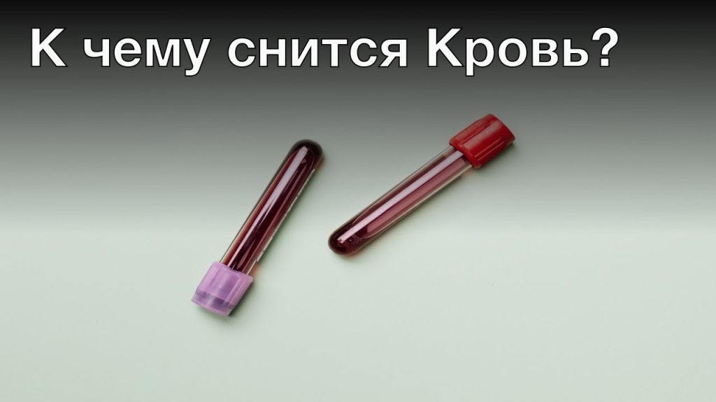 К Чему Снится Кровь: Толкования и Символика Крови во Снах